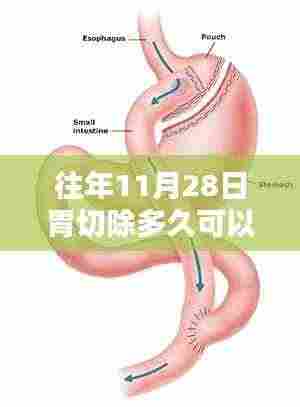 往年11月28日胃切除手术时机详解,多久可以进行二次手术?