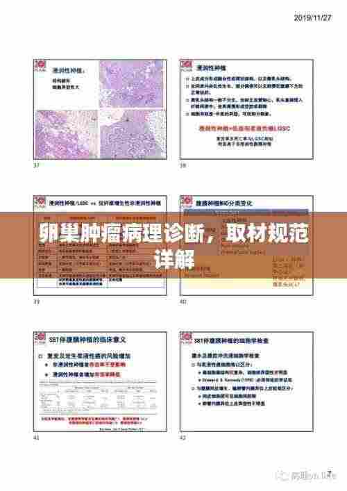 卵巢肿瘤病理诊断,取材规范详解